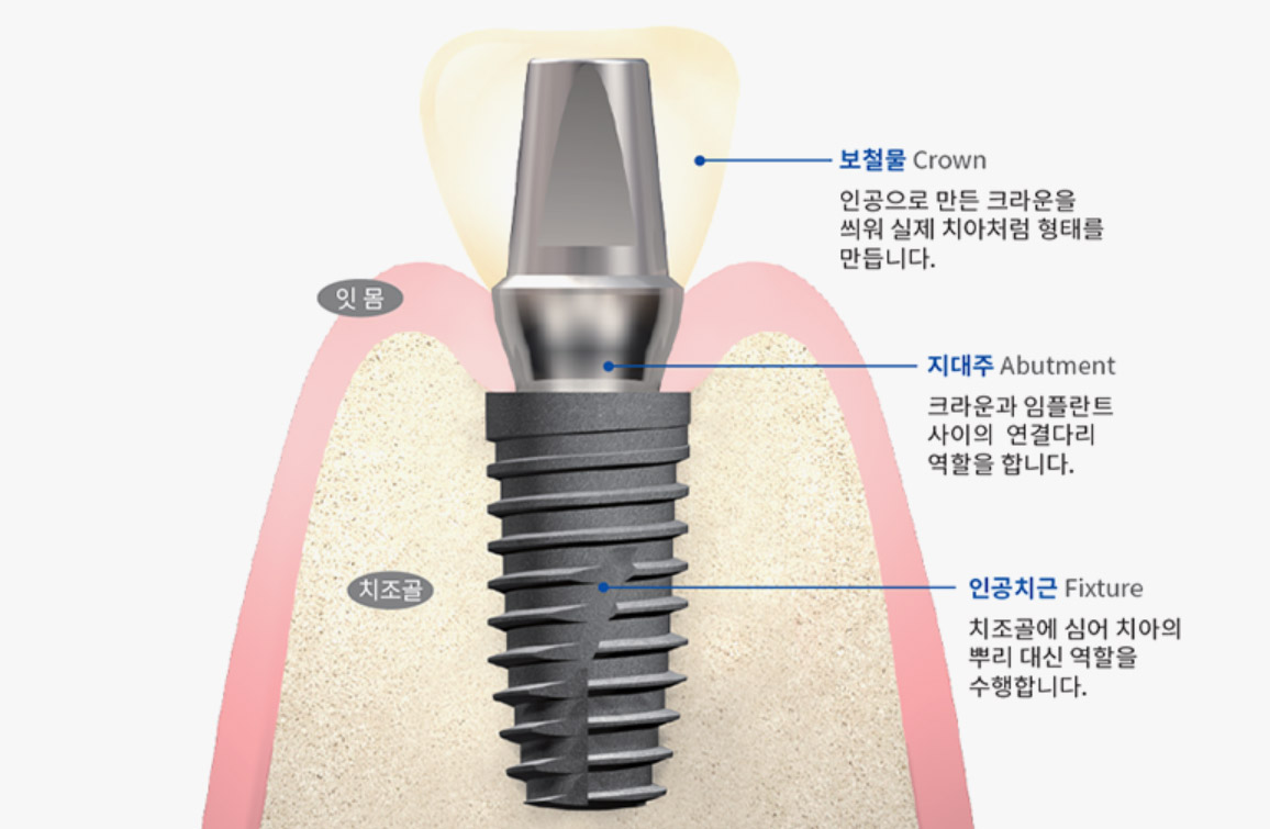 제품 이미지